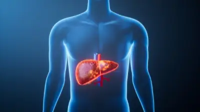 تحذير صحي: 1.8 مليار شخص مهددون بمرض الكبد الدهني بحلول 2050