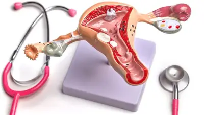 بطانة الرحم المهاجرة: أعراضها وأسبابها وطرق العلاج المتاحة