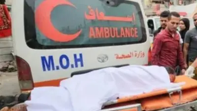 مدير مستشفى يحذر من انتشار فيروس الجدري المائي بين أطفال غزة وسط إجراءات عاجلة