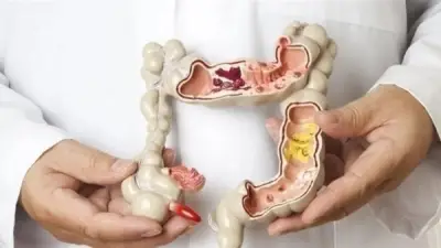 تهيج القولون العصبي: أعراضه المزعجة والأطعمة الممنوعة لتفادي الألم الحاد