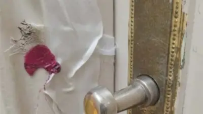 حملة مفاجئة للعلاج الحر في دمنهور تسفر عن تشميع مركز طبي خاص