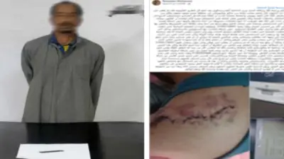 خلاف على الأجرة.. سائق ميكروباص يعتدي على راكب بسلاح أبيض في غمرة