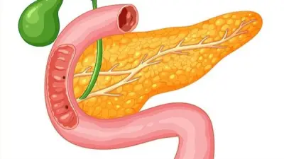 أخصائي رعاية يكشف أسباب وأعراض التهاب البنكرياس ومضاعفاته