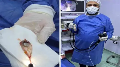 إنقاذ طفلة بعد استخراج بطارية من معدة بمستشفى أبو كبير بالشرقية