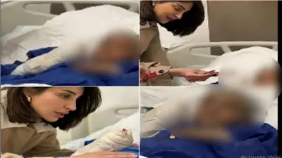 الطفل مالك ضحية عنف أسري.. والدته عاقبته بالماء المغلي ويخضع لدعم نفسي