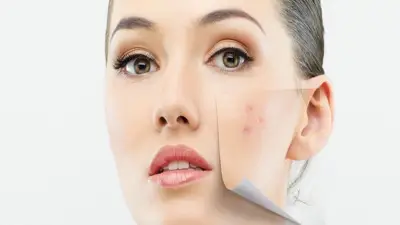 مشاكل جلدية تهددك في الصيف: طرق فعالة لحماية بشرتك