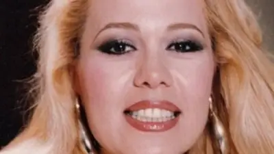 إصابة الفنانة إيمان بكسر في المعصم وطرق علاجها