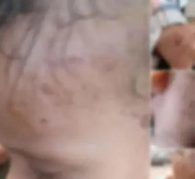 حقيقة الصور المتداولة لطفل مصاب بالشرقية: ليست واقعة تعذيب