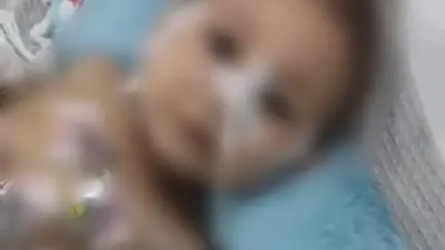 أسرة طفلة الصف تناشد الصحة: أنقذوها تحتاج معدة صناعية بعد استئصال معدتها