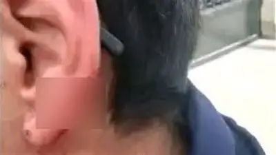 طالب يعض زميله ويقطع جزءًا من أذنه في حادثة صادمة بمدرسة الإسكندرية