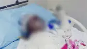 طفلة الشرقية تودع الحياة بعد حروق مميتة.. والنيابة تفتح تحقيقًا موسعًا
