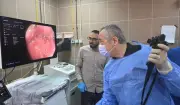 تشخيص فوري للأورام المنظار المكبر يدخل الخدمة بمستشفى أحمد ماهر