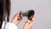 تساقط الشعر: الأسباب الرئيسية والأنواع المختلفة وطرق العلاج الفعالة