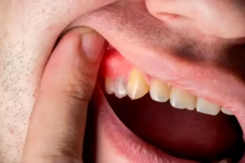 14 تغييراً في العادات اليومية لعلاج التهابات اللثة ورائحة الفم