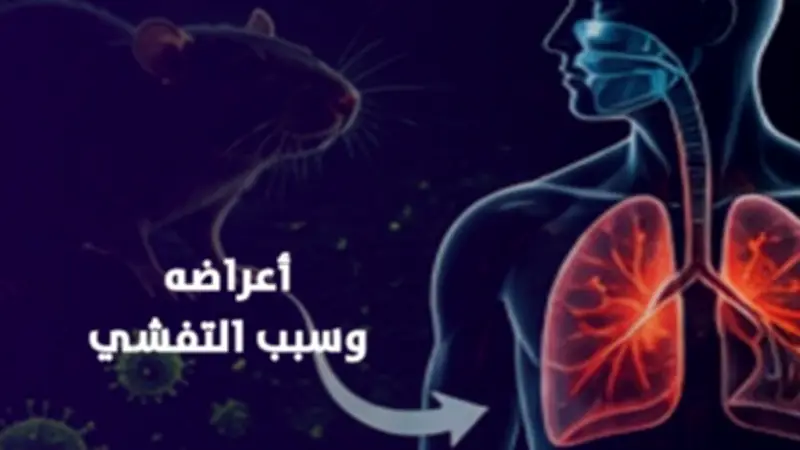 فيروس هانتا يثير الذعر عالمياً بعد وفاة 3 ركاب على سفينة سياحية