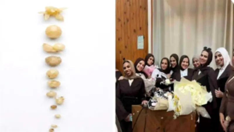 طالبات بجامعة الزقازيق ينتجن 3 أصناف بطاطس خالية من الفيروسات