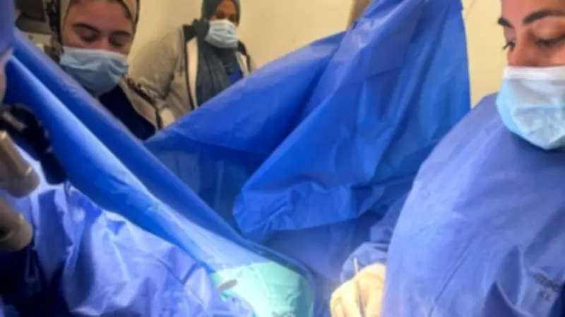 إنجاز طبي بجامعة بنها.. استبدال الصمام المترالي بتقنية دقيقة دون فتح عظمة القص