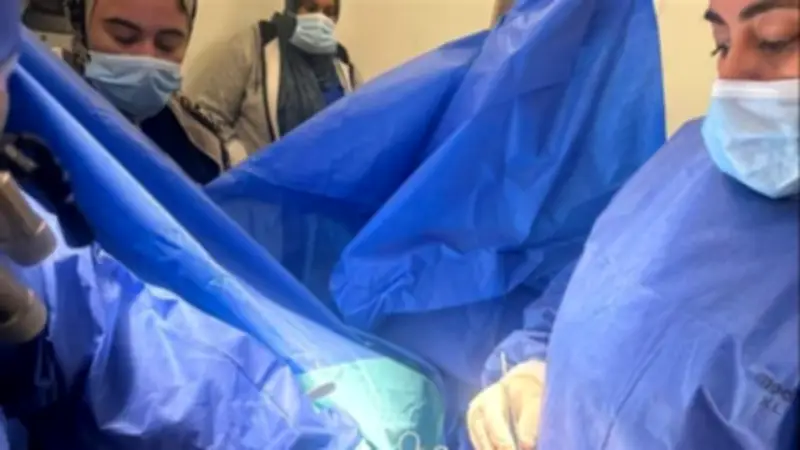 نجاح جراحة قلب متقدمة لاستبدال الصمام المترالي بمستشفيات بنها الجامعية