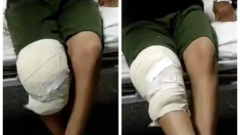 فريق طبي بجامعة أسيوط ينهي معاناة مريض هيموفيليا بجراحة منظار