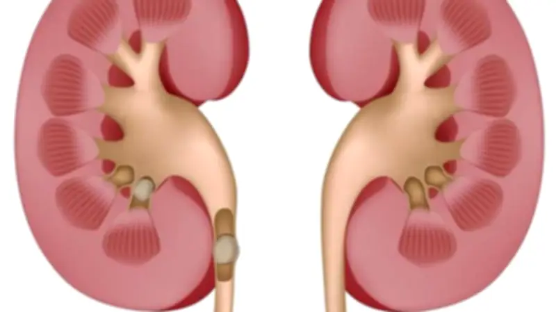 عامل خفي يزيد خطر الإصابة بأمراض الكلى.. الهواء الملوث
