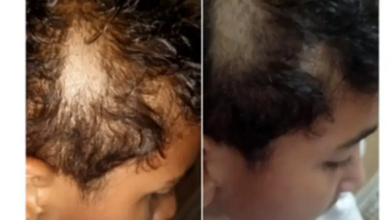 تعليم القاهرة تحقق في واقعة حلاقة شعر تلميذ بالطابور