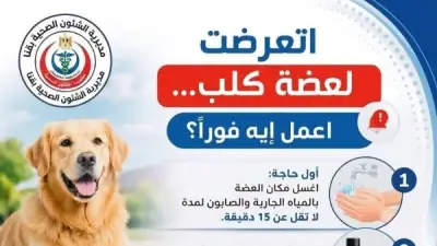 صحة قنا تخصص 22 مركزا للوقاية من السعار وتوفير المصل للمواطنين