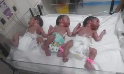 عراقية تنجب 3 توائم بعد عقم دام 20 عامًا في معجزة طبية