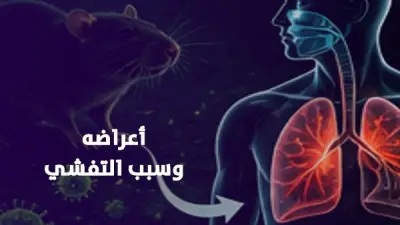 فيروس هانتا يثير الذعر عالمياً بعد وفاة 3 ركاب على سفينة سياحية