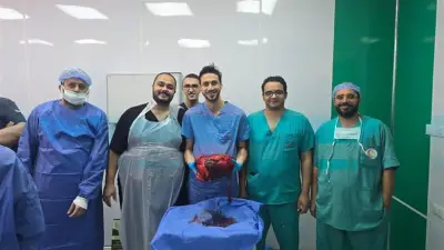 نجاح جراحة نادرة لاستئصال ورم وزنه 30 كجم من بطن مريض بالمنوفية