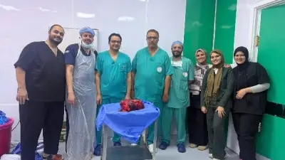 نجاح استئصال ورم نادر وزنه 30 كيلو من بطن مريض بالمنوفية