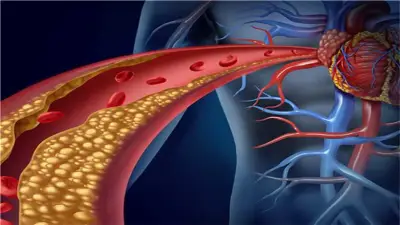 وجبة غداء لمحاربة الكوليسترول الضار في 5 دقائق فقط