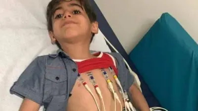 رجل أعمال إماراتي يتبرع بـ90 مليون جنيه لإنقاذ طفل مصري من ضمور العضلات