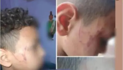 معلمة تعتدي على طالب بالضرب المبرح في مدرسة بسوهاج
