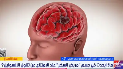 خطر التوقف عن الأنسولين: طبيبة تحذر من مضاعفات قاتلة لمرضى السكري
