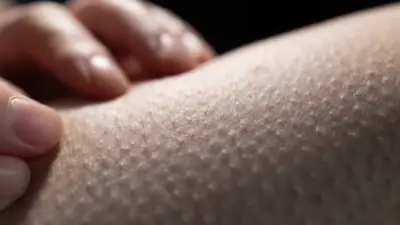 هل القشعريرة المتكررة علامة خطر؟ تعرف على أسبابها المفاجئة