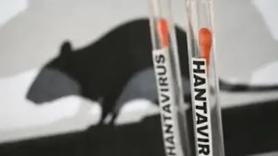 فيروس هانتا يسبب الوفاة.. طرق الوقاية لتجنب العدوى
