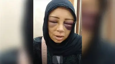 فتاة ببورسعيد تكشف تفاصيل اعتداء خطيبها السابق عليها في الكوافير