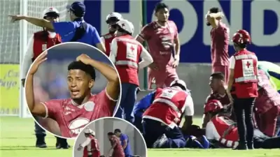 إصابة مروعة للبرازيلي روماريو دا سيلفا في الدوري الهندوراسي