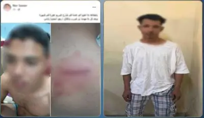 خلافات الجيرة تكشف لغز إصابة مواطن بجرح قطعي في ظهره بالجيزة
