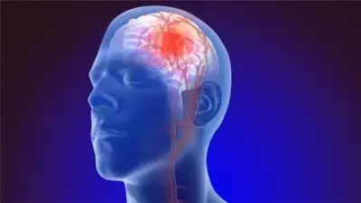 وزارة الصحة تحذر: جلطة المخ تبدأ بأعراض مفاجئة لا تتجاهلها