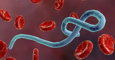 منظمة الصحة العالمية تعلن تفشي فيروس إيبولا في الكونغو وأوغندا