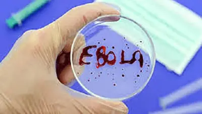 بعد إعلان حالة الطوارئ.. هل يوجد لقاح لفيروس إيبولا؟