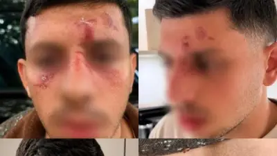 إسرائيلي يتعرض لاعتداء عنيف في لندن أثناء حديثه بالعبرية