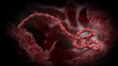 أستاذ أوبئة: النزيف الداخلي من أعراض إيبولا الخطيرة ومن الصعب تحوله لجائحة