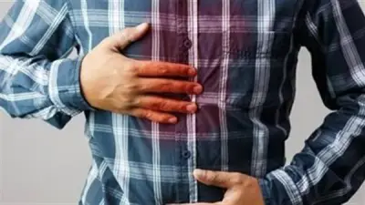 علامات تؤكد الإصابة بضعف حمض المعدة وأعراضه وأسبابه وطرق علاجه