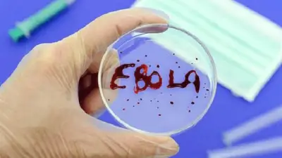 علماء بريطانيون يطورون لقاحاً تجريبياً جديداً لفيروس إيبولا لمواجهة تفشيه في أفريقيا