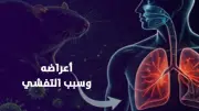 فيروس هانتا يثير الذعر عالمياً بعد وفاة 3 ركاب على سفينة سياحية