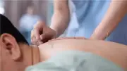 الوخز بالإبر ليس وهماً.. دراسة تكشف آلياته في تسكين الآلام