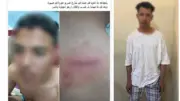 ضبط عاطل تعدى على شاب وأصابه بسبب خلافات الجيرة في الجيزة