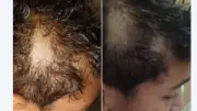 معلم يحلق شعر تلميذ أمام زملائه في الطابور بمدرسة مصر الجديدة